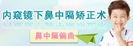 鼻中隔偏曲的危害